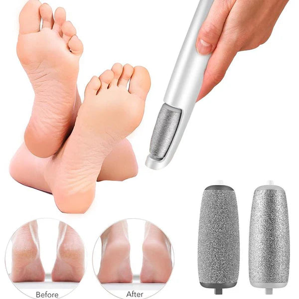 🔥2025Heißer Verkauf💥Electric Foot Scrubber for Smooth Healthy Skin