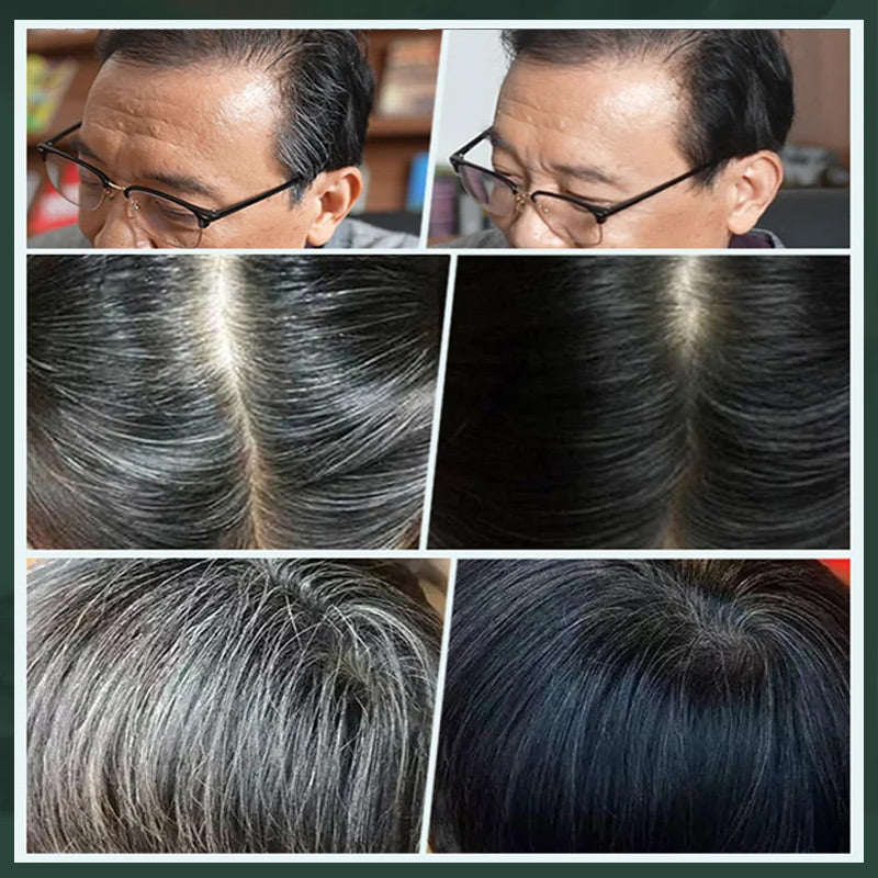✨ Von grau zu wunderschön in 5 Minuten! Deutsche Labormagie - 100% Pflanzenkraft für salon-perfekte Haarwurzeln!