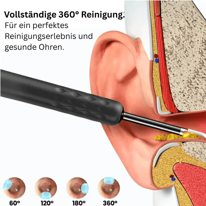 LUNAVA™ Pro Ohrenschmalz-Entfernungsgerät mit HD-Kamera