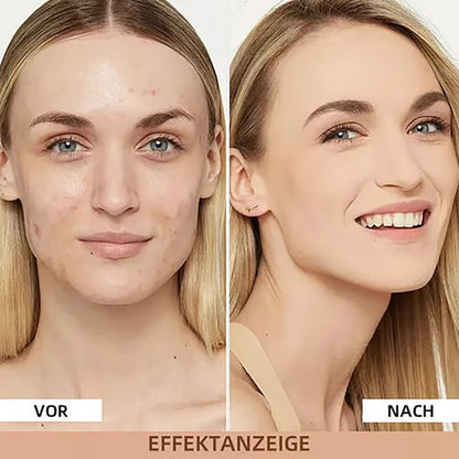 🔥Letzter Verkaufstag 49% Rabatt 🎁 Mikrobiom 4-in-1 Foundation