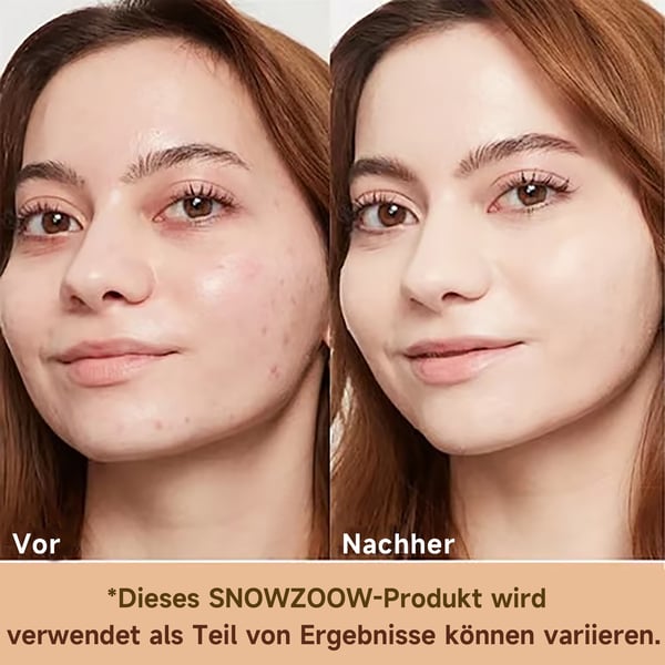 🔥Letzter Verkaufstag 49% Rabatt 🎁 Mikrobiom 4-in-1 Foundation