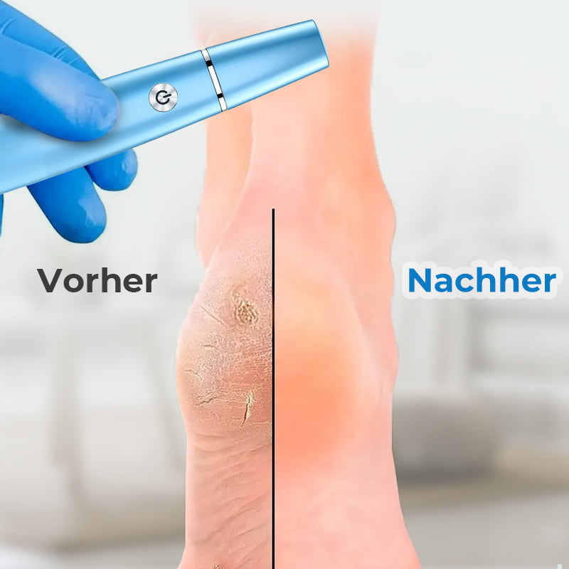 Fußpflege Elektrische Fußschleifmaschine