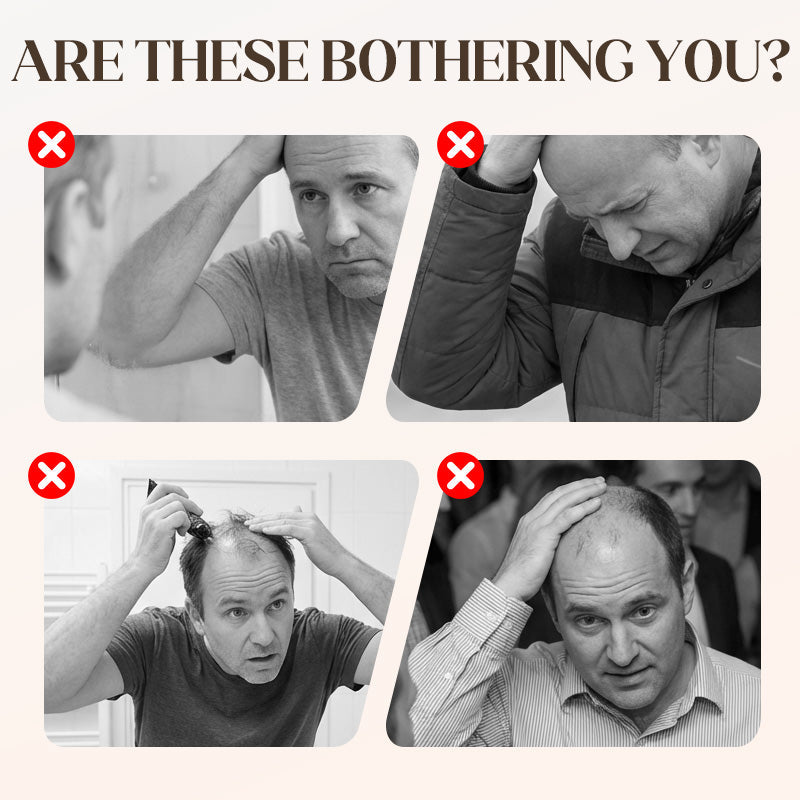 📢📢50 % RABATT!! ⏰ Unisex-Style – eine Perückenkappe = ganztägige Freiheit für Ihre Hip-Hop-Frisur! 💫✨